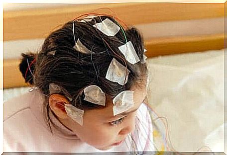 There are various treatments available to deal with childhood epilepsy.