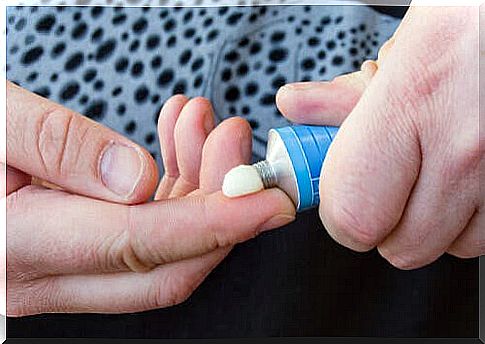 A person putting on corticosteroid cream