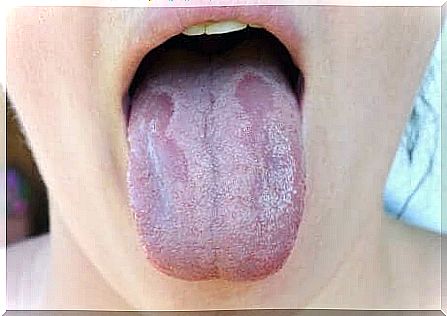 Diseases of the tongue.