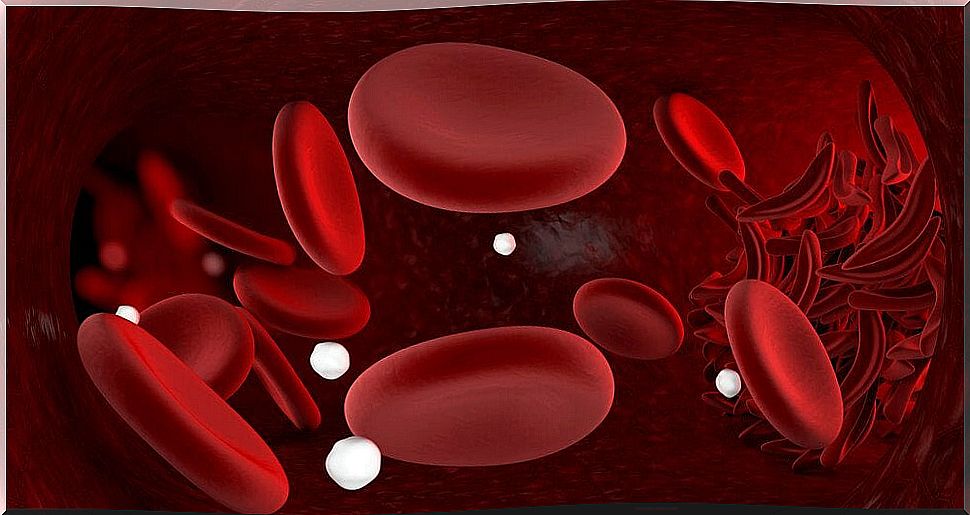 Infallible remedies to fight anemia in a natural way