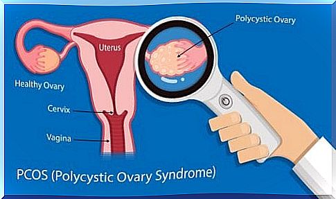 Diagram of the female genitalia. 