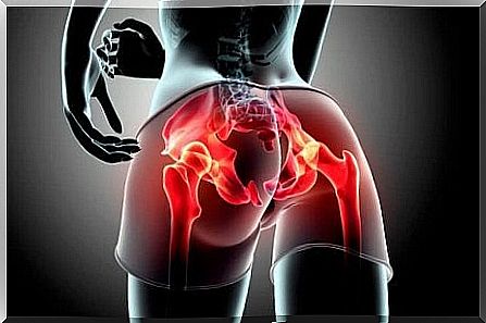 The diagram of gluteal tendinopathy