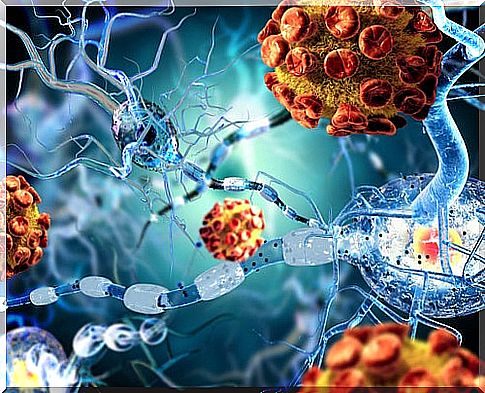 Meningitis, meninges disease